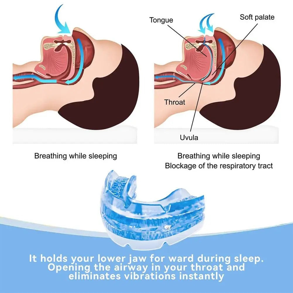 Anti Snoring Mouthpiece