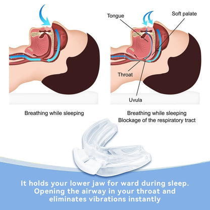 Anti Snoring Mouthpiece